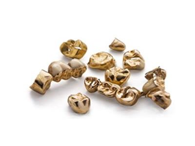 Zahngold verkaufen Tuttlingen