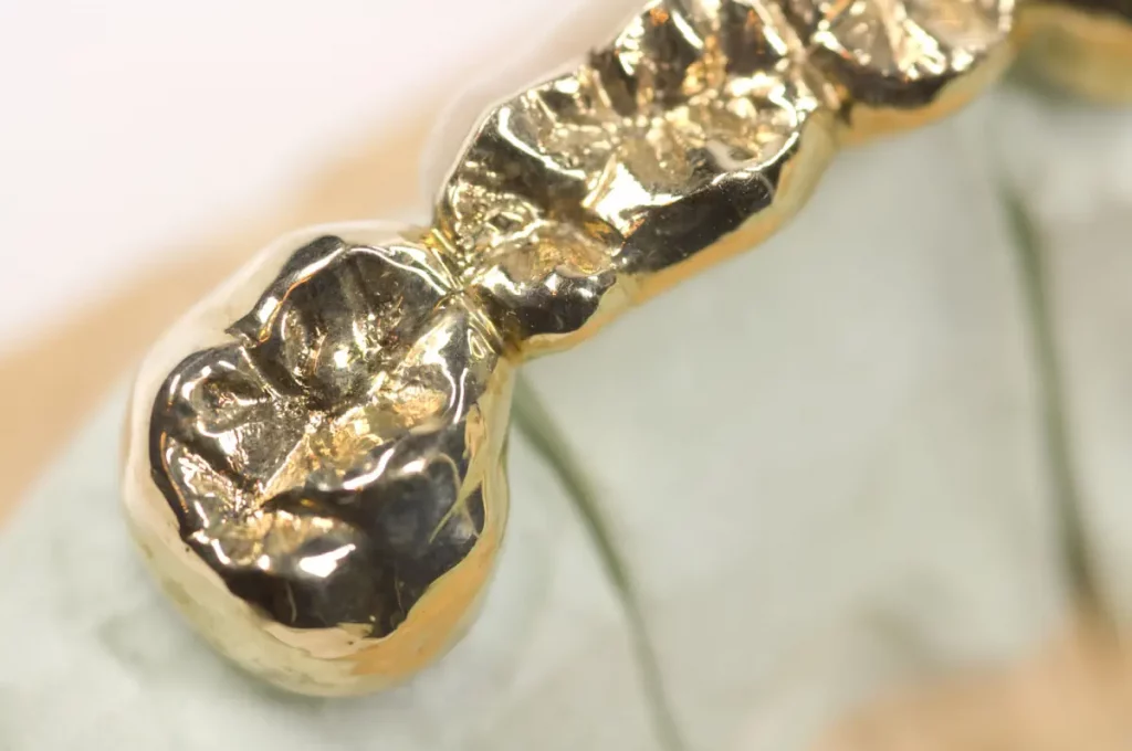 Zahngold verkaufen